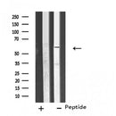 Western blot analysis of extracts from Hela cells, using CP26C antibody.