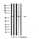 DF4756 staining HT29 cells by IF/ICC. The sample were fixed with PFA and permeabilized in 0.1% Triton X-100,then blocked in 10% serum for 45 minutes at 25¡ãC. The primary antibody was diluted at 1/200 and incubated with the sample for 1 hour at 37¡ãC. An Alexa Fluor 594 conjugated goat anti-rabbit IgG (H+L) antibody(Cat.