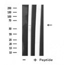 DF4758 staining HT29 cells by IF/ICC. The sample were fixed with PFA and permeabilized in 0.1% Triton X-100,then blocked in 10% serum for 45 minutes at 25¡ãC. The primary antibody was diluted at 1/200 and incubated with the sample for 1 hour at 37¡ãC. An Alexa Fluor 594 conjugated goat anti-rabbit IgG (H+L) antibody(Cat.