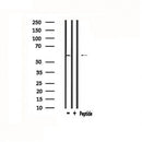 DF4768 at 1/100 staining Mouse brain tissue by IHC-P. The sample was formaldehyde fixed and a heat mediated antigen retrieval step in citrate buffer was performed. The sample was then blocked and incubated with the antibody for 1.5 hours at 22¡ãC. An HRP conjugated goat anti-rabbit antibody was used as the secondary