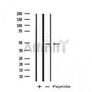 DF4769 at 1/100 staining Rat lung tissue by IHC-P. The sample was formaldehyde fixed and a heat mediated antigen retrieval step in citrate buffer was performed. The sample was then blocked and incubated with the antibody for 1.5 hours at 22¡ãC. An HRP conjugated goat anti-rabbit antibody was used as the secondary