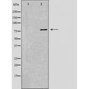 DF4787 at 1/100 staining Human gastric tissue by IHC-P. The sample was formaldehyde fixed and a heat mediated antigen retrieval step in citrate buffer was performed. The sample was then blocked and incubated with the antibody for 1.5 hours at 22¡ãC. An HRP conjugated goat anti-rabbit antibody was used as the secondary