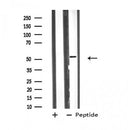 DF4796 staining HepG2 by IF/ICC. The sample were fixed with PFA and permeabilized in 0.1% Triton X-100,then blocked in 10% serum for 45 minutes at 25¡ãC. The primary antibody was diluted at 1/200 and incubated with the sample for 1 hour at 37¡ãC. An Alexa Fluor 594 conjugated goat anti-rabbit IgG (H+L) Ab, diluted at 1/600, was used as the secondary antibod