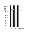 DF4798 staining Hela cells by IF/ICC. The sample were fixed with PFA and permeabilized in 0.1% Triton X-100,then blocked in 10% serum for 45 minutes at 25¡ãC. The primary antibody was diluted at 1/200 and incubated with the sample for 1 hour at 37¡ãC. An Alexa Fluor 594 conjugated goat anti-rabbit IgG (H+L) antibody(Cat.