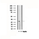 DF4804 staining HuvEc cells by IF/ICC. The sample were fixed with PFA and permeabilized in 0.1% Triton X-100,then blocked in 10% serum for 45 minutes at 25¡ãC. The primary antibody was diluted at 1/200 and incubated with the sample for 1 hour at 37¡ãC. An Alexa Fluor 594 conjugated goat anti-rabbit IgG (H+L) antibody(Cat.