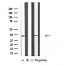 DF4812 staining Hela by IF/ICC. The sample were fixed with PFA and permeabilized in 0.1% Triton X-100,then blocked in 10% serum for 45 minutes at 25¡ãC. The primary antibody was diluted at 1/200 and incubated with the sample for 1 hour at 37¡ãC. An Alexa Fluor 594 conjugated goat anti-rabbit IgG (H+L) Ab, diluted at 1/600, was used as the secondary antibod