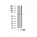 DF4887 staining COLO205 by IF/ICC. The sample were fixed with PFA and permeabilized in 0.1% Triton X-100,then blocked in 10% serum for 45 minutes at 25¡ãC. The primary antibody was diluted at 1/200 and incubated with the sample for 1 hour at 37¡ãC. An Alexa Fluor 594 conjugated goat anti-rabbit IgG (H+L) Ab, diluted at 1/600, was used as the secondary antibod