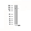 DF4821 staining 293 cells by IF/ICC. The sample were fixed with PFA and permeabilized in 0.1% Triton X-100,then blocked in 10% serum for 45 minutes at 25¡ãC. The primary antibody was diluted at 1/200 and incubated with the sample for 1 hour at 37¡ãC. An Alexa Fluor 594 conjugated goat anti-rabbit IgG (H+L) antibody(Cat.