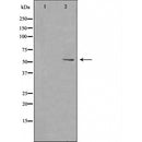 DF4845 staining HeLa by IF/ICC. The sample were fixed with PFA and permeabilized in 0.1% Triton X-100,then blocked in 10% serum for 45 minutes at 25¡ãC. The primary antibody was diluted at 1/200 and incubated with the sample for 1 hour at 37¡ãC. An Alexa Fluor 594 conjugated goat anti-rabbit IgG (H+L) Ab, diluted at 1/600, was used as the secondary antibod