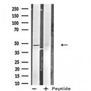 DF4854 staining HuvEc by IF/ICC. The sample were fixed with PFA and permeabilized in 0.1% Triton X-100,then blocked in 10% serum for 45 minutes at 25¡ãC. The primary antibody was diluted at 1/200 and incubated with the sample for 1 hour at 37¡ãC. An Alexa Fluor 594 conjugated goat anti-rabbit IgG (H+L) Ab, diluted at 1/600, was used as the secondary antibod