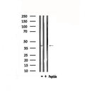 DF4856 staining Hela by IF/ICC. The sample were fixed with PFA and permeabilized in 0.1% Triton X-100,then blocked in 10% serum for 45 minutes at 25¡ãC. The primary antibody was diluted at 1/200 and incubated with the sample for 1 hour at 37¡ãC. An Alexa Fluor 594 conjugated goat anti-rabbit IgG (H+L) Ab, diluted at 1/600, was used as the secondary antibod