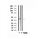 DF4865 staining COLO205 by IF/ICC. The sample were fixed with PFA and permeabilized in 0.1% Triton X-100,then blocked in 10% serum for 45 minutes at 25¡ãC. The primary antibody was diluted at 1/200 and incubated with the sample for 1 hour at 37¡ãC. An Alexa Fluor 594 conjugated goat anti-rabbit IgG (H+L) Ab, diluted at 1/600, was used as the secondary antibod