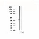 DF4867 staining 293T by IF/ICC. The sample were fixed with PFA and permeabilized in 0.1% Triton X-100,then blocked in 10% serum for 45 minutes at 25¡ãC. The primary antibody was diluted at 1/200 and incubated with the sample for 1 hour at 37¡ãC. An Alexa Fluor 594 conjugated goat anti-rabbit IgG (H+L) Ab, diluted at 1/600, was used as the secondary antibod