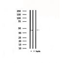 DF4877 staining MCF7 by IF/ICC. The sample were fixed with PFA and permeabilized in 0.1% Triton X-100,then blocked in 10% serum for 45 minutes at 25¡ãC. The primary antibody was diluted at 1/200 and incubated with the sample for 1 hour at 37¡ãC. An Alexa Fluor 594 conjugated goat anti-rabbit IgG (H+L) Ab, diluted at 1/600, was used as the secondary antibod