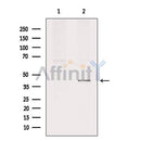 Western blot analysis of extracts from 293, using PE2R2 Antibody. Lane 1 was treated with the blocking peptide.