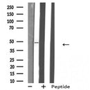 DF4889 staining Hela by IF/ICC. The sample were fixed with PFA and permeabilized in 0.1% Triton X-100,then blocked in 10% serum for 45 minutes at 25¡ãC. The primary antibody was diluted at 1/200 and incubated with the sample for 1 hour at 37¡ãC. An Alexa Fluor 594 conjugated goat anti-rabbit IgG (H+L) Ab, diluted at 1/600, was used as the secondary antibod