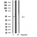DF4897 staining Hela by IF/ICC. The sample were fixed with PFA and permeabilized in 0.1% Triton X-100,then blocked in 10% serum for 45 minutes at 25¡ãC. The primary antibody was diluted at 1/200 and incubated with the sample for 1 hour at 37¡ãC. An Alexa Fluor 594 conjugated goat anti-rabbit IgG (H+L) Ab, diluted at 1/600, was used as the secondary antibod