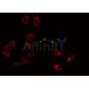 DF4911 staining Hela by IF/ICC. The samples were fixed with PFA and permeabilized in 0.1% Triton X-100,then blocked in 10% serum for 45 minutes at 25¡ãC. Samples were then incubated with primary Ab(DF4911 1:200) and mouse anti-beta tubulin Ab(T0023 1:200) for 1 hour at 37¡ãC. An AlexaFluor594 conjugated goat anti-rabbit IgG(H+L) Ab(S0006 Red 1:600) and an AlexaFluor488 conjugated goat anti-mouse IgG(H+L) Ab(S0017 Green 1:600) were used as the secondary antibod