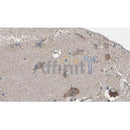 Western blot analysis of extracts from HepG2 and mouse lung, using CNR1 Antibody.