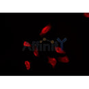 Western blot analysis of extracts from COS-7, using EDG4 Antibody. The lane on the left was treated with blocking peptide.