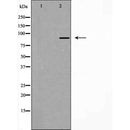 DF4924 staining COLO205 by IF/ICC. The sample were fixed with PFA and permeabilized in 0.1% Triton X-100,then blocked in 10% serum for 45 minutes at 25¡ãC. The primary antibody was diluted at 1/200 and incubated with the sample for 1 hour at 37¡ãC. An Alexa Fluor 594 conjugated goat anti-rabbit IgG (H+L) Ab, diluted at 1/600, was used as the secondary antibod