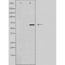 DF4939 staining HuvEc by IF/ICC. The sample were fixed with PFA and permeabilized in 0.1% Triton X-100,then blocked in 10% serum for 45 minutes at 25¡ãC. The primary antibody was diluted at 1/200 and incubated with the sample for 1 hour at 37¡ãC. An Alexa Fluor 594 conjugated goat anti-rabbit IgG (H+L) Ab, diluted at 1/600, was used as the secondary antibod
