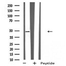 DF4962 staining Hela cells by IF/ICC. The sample were fixed with PFA and permeabilized in 0.1% Triton X-100,then blocked in 10% serum for 45 minutes at 25¡ãC. The primary antibody was diluted at 1/200 and incubated with the sample for 1 hour at 37¡ãC. An Alexa Fluor 594 conjugated goat anti-rabbit IgG (H+L) antibody(Cat.