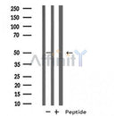 DF4981 staining COLO205 by IF/ICC. The sample were fixed with PFA and permeabilized in 0.1% Triton X-100,then blocked in 10% serum for 45 minutes at 25¡ãC. The primary antibody was diluted at 1/200 and incubated with the sample for 1 hour at 37¡ãC. An Alexa Fluor 594 conjugated goat anti-rabbit IgG (H+L) Ab, diluted at 1/600, was used as the secondary antibod
