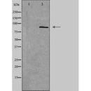 DF5152 staining HuvEc by IF/ICC. The sample were fixed with PFA and permeabilized in 0.1% Triton X-100,then blocked in 10% serum for 45 minutes at 25¡ãC. The primary antibody was diluted at 1/200 and incubated with the sample for 1 hour at 37¡ãC. An Alexa Fluor 594 conjugated goat anti-rabbit IgG (H+L) Ab, diluted at 1/600, was used as the secondary antibod