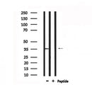 Western blot analysis of extracts from 293, using MSHR Antibody. Lane 1 was treated with the antigen-specific peptide.