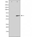DF4997 staining COLO205 by IF/ICC. The sample were fixed with PFA and permeabilized in 0.1% Triton X-100,then blocked in 10% serum for 45 minutes at 25¡ãC. The primary antibody was diluted at 1/200 and incubated with the sample for 1 hour at 37¡ãC. An Alexa Fluor 594 conjugated goat anti-rabbit IgG (H+L) Ab, diluted at 1/600, was used as the secondary antibod