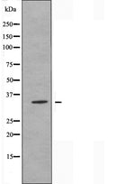 DF5016 staining MCF7 by IF/ICC. The sample were fixed with PFA and permeabilized in 0.1% Triton X-100,then blocked in 10% serum for 45 minutes at 25¡ãC. The primary antibody was diluted at 1/200 and incubated with the sample for 1 hour at 37¡ãC. An Alexa Fluor 594 conjugated goat anti-rabbit IgG (H+L) Ab, diluted at 1/600, was used as the secondary antibod