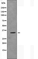 DF5020 staining HeLa by IF/ICC. The sample were fixed with PFA and permeabilized in 0.1% Triton X-100,then blocked in 10% serum for 45 minutes at 25¡ãC. The primary antibody was diluted at 1/200 and incubated with the sample for 1 hour at 37¡ãC. An Alexa Fluor 594 conjugated goat anti-rabbit IgG (H+L) Ab, diluted at 1/600, was used as the secondary antibod
