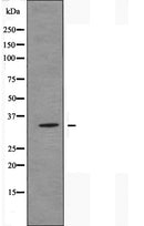 DF5021 staining Hela by IF/ICC. The sample were fixed with PFA and permeabilized in 0.1% Triton X-100,then blocked in 10% serum for 45 minutes at 25¡ãC. The primary antibody was diluted at 1/200 and incubated with the sample for 1 hour at 37¡ãC. An Alexa Fluor 594 conjugated goat anti-rabbit IgG (H+L) Ab, diluted at 1/600, was used as the secondary antibod