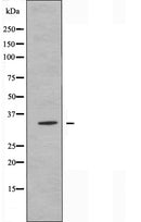DF5023 staining HuvEc by IF/ICC. The sample were fixed with PFA and permeabilized in 0.1% Triton X-100,then blocked in 10% serum for 45 minutes at 25¡ãC. The primary antibody was diluted at 1/200 and incubated with the sample for 1 hour at 37¡ãC. An Alexa Fluor 594 conjugated goat anti-rabbit IgG (H+L) Ab, diluted at 1/600, was used as the secondary antibod