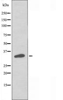 DF5034 staining HuvEc by IF/ICC. The sample were fixed with PFA and permeabilized in 0.1% Triton X-100,then blocked in 10% serum for 45 minutes at 25¡ãC. The primary antibody was diluted at 1/200 and incubated with the sample for 1 hour at 37¡ãC. An Alexa Fluor 594 conjugated goat anti-rabbit IgG (H+L) Ab, diluted at 1/600, was used as the secondary antibod