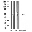 DF5044 staining Hela by IF/ICC. The sample were fixed with PFA and permeabilized in 0.1% Triton X-100,then blocked in 10% serum for 45 minutes at 25¡ãC. The primary antibody was diluted at 1/200 and incubated with the sample for 1 hour at 37¡ãC. An Alexa Fluor 594 conjugated goat anti-rabbit IgG (H+L) Ab, diluted at 1/600, was used as the secondary antibod