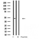 DF5138 staining HepG2 by IF/ICC. The sample were fixed with PFA and permeabilized in 0.1% Triton X-100,then blocked in 10% serum for 45 minutes at 25¡ãC. The primary antibody was diluted at 1/200 and incubated with the sample for 1 hour at 37¡ãC. An Alexa Fluor 594 conjugated goat anti-rabbit IgG (H+L) Ab, diluted at 1/600, was used as the secondary antibod