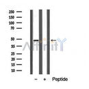 DF5170 staining COLO205 cells by IF/ICC. The sample were fixed with PFA and permeabilized in 0.1% Triton X-100,then blocked in 10% serum for 45 minutes at 25¡ãC. The primary antibody was diluted at 1/200 and incubated with the sample for 1 hour at 37¡ãC. An Alexa Fluor 594 conjugated goat anti-rabbit IgG (H+L) antibody(Cat.