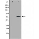 DF5172 staining HT29 by IF/ICC. The sample were fixed with PFA and permeabilized in 0.1% Triton X-100,then blocked in 10% serum for 45 minutes at 25¡ãC. The primary antibody was diluted at 1/200 and incubated with the sample for 1 hour at 37¡ãC. An Alexa Fluor 594 conjugated goat anti-rabbit IgG (H+L) Ab, diluted at 1/600, was used as the secondary antibod