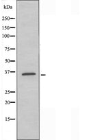 DF5178 staining Hela by IF/ICC. The sample were fixed with PFA and permeabilized in 0.1% Triton X-100,then blocked in 10% serum for 45 minutes at 25¡ãC. The primary antibody was diluted at 1/200 and incubated with the sample for 1 hour at 37¡ãC. An Alexa Fluor 594 conjugated goat anti-rabbit IgG (H+L) Ab, diluted at 1/600, was used as the secondary antibod
