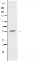 DF5185 staining Hela by IF/ICC. The sample were fixed with PFA and permeabilized in 0.1% Triton X-100,then blocked in 10% serum for 45 minutes at 25¡ãC. The primary antibody was diluted at 1/200 and incubated with the sample for 1 hour at 37¡ãC. An Alexa Fluor 594 conjugated goat anti-rabbit IgG (H+L) Ab, diluted at 1/600, was used as the secondary antibod