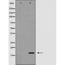 Western blot analysis of Interleukin 2 expression in HT-29 cells,The lane on the left is treated with the antigen-specific peptide.