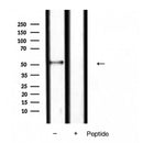 Western blot analysis of extracts from various samples, using Smad9 Antibody.
Lane 1: RAW264.7, treated with blocking peptide;
Lane 2: RAW264.7;
Lane 3: Pc12.