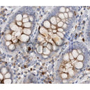 Western blot analysis on Human Spleen lysate using CD63 antibody