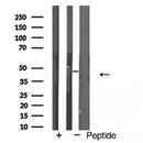 AF5127 staining HepG2 by IF/ICC. The sample were fixed with PFA and permeabilized in 0.1% Triton X-100,then blocked in 10% serum for 45 minutes at 25¡ãC. The primary antibody was diluted at 1/200 and incubated with the sample for 1 hour at 37¡ãC. An Alexa Fluor 594 conjugated goat anti-rabbit IgG (H+L) Ab, diluted at 1/600, was used as the secondary antibod