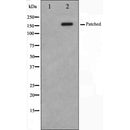 AF5202 staining 293 by IF/ICC. The sample were fixed with PFA and permeabilized in 0.1% Triton X-100,then blocked in 10% serum for 45 minutes at 25¡ãC. The primary antibody was diluted at 1/200 and incubated with the sample for 1 hour at 37¡ãC. An Alexa Fluor 594 conjugated goat anti-rabbit IgG (H+L) Ab, diluted at 1/600, was used as the secondary antibod