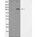 Western blot analysis of EPHB1 expression in COS7 cells,The lane on the left is treated with the antigen-specific peptide.