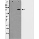 AF5243 staining A-431 cells by ICC/IF. Cells were fixed with PFA and permeabilized in 0.1% saponin prior to blocking in 10% serum for 45 minutes at 37¡ãC. The primary antibody was diluted 1/200 and incubated with the sample for 1 hour at 37¡ãC. A Alexa Fluor 594 conjugated goat polyclonal to rabbit IgG (H+L), diluted 1/600 was used as secondary antibod