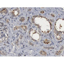 AF5244 staining Hela by IF/ICC. The samples were fixed with PFA and permeabilized in 0.1% Triton X-100,then blocked in 10% serum for 45 minutes at 25¡ãC. Samples were then incubated with primary Ab(AF5244 1:200) and mouse anti-beta tubulin Ab(T0023 1:200) for 1 hour at 37¡ãC. An AlexaFluor594 conjugated goat anti-rabbit IgG(H+L) Ab(S0006 1:200 Red) and an AlexaFluor488 conjugated goat anti-mouse IgG(H+L) Ab(S0017 1:600 Green) were used as the secondary antibod